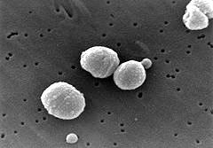 Pneumokokken (Von CDC/Janice Carr)