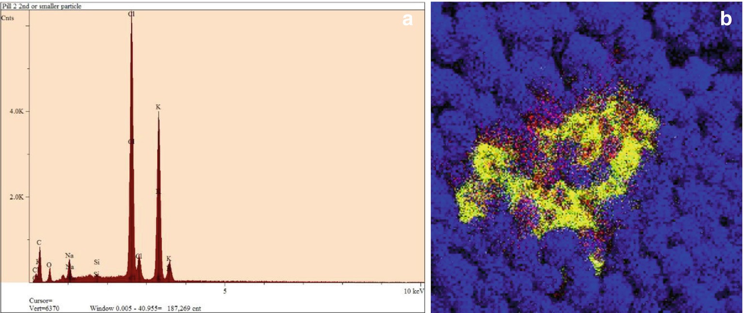 /epubstore/N/S-S-Nielsen/Food-Analysis/OEBPS/images/104747_5_En_32_Chapter/104747_5_En_32_Fig5_HTML.jpg